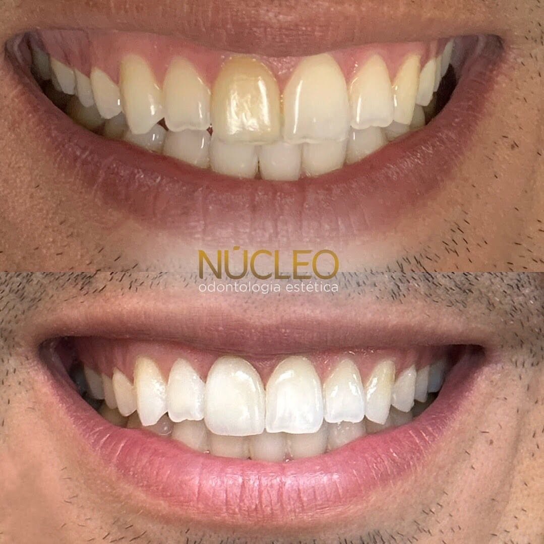 Núcleo Odontologia | Conheça a clínica em Juiz de Fora